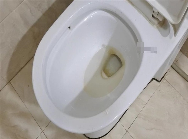 Thức ăn thừa bám lại dẫn đến tình trạng bồn cầu bị ố vàng